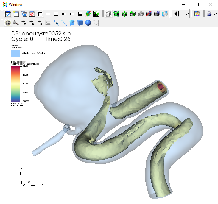 ../_images/Aneurysm-SubsetIsoSurface.png