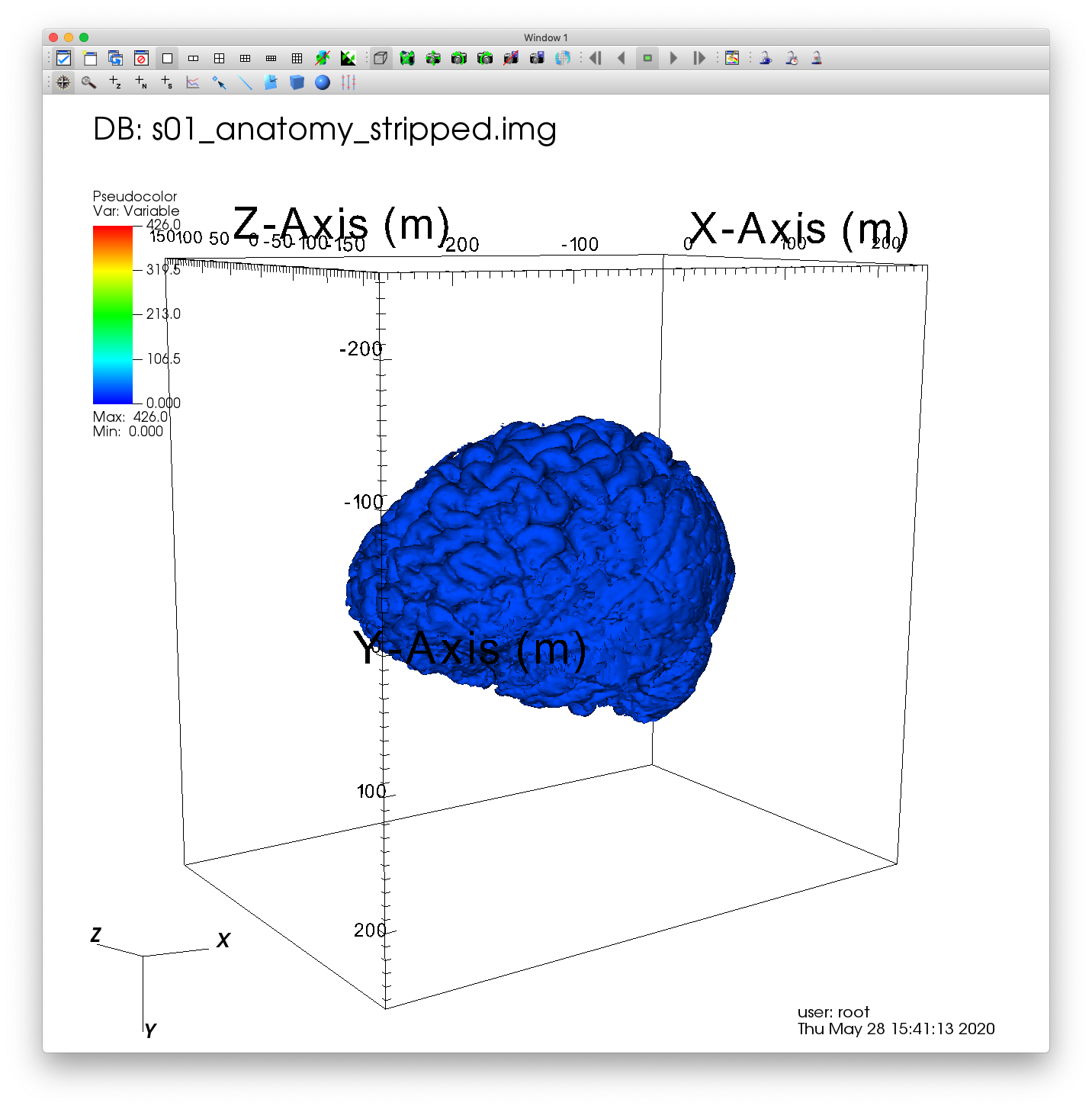 ../_images/MRI_Blue_Brain.png